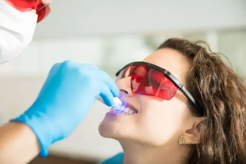 Laser Teeth Whitening FAQs Wellingborough &ndash; Your Ultimate Guide Wellingborough